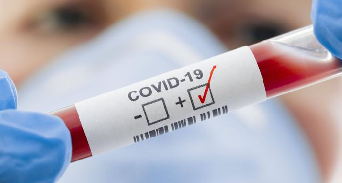 Регистрирани болни от COVID -19 на територията на община Велики Преслав